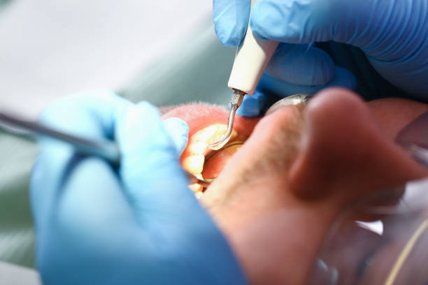 Best Root Canal Emergency Dentist  in Panhandle, TX